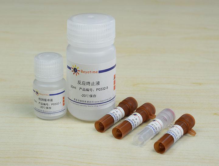 抗酒石酸酸性磷酸酶检测试剂盒